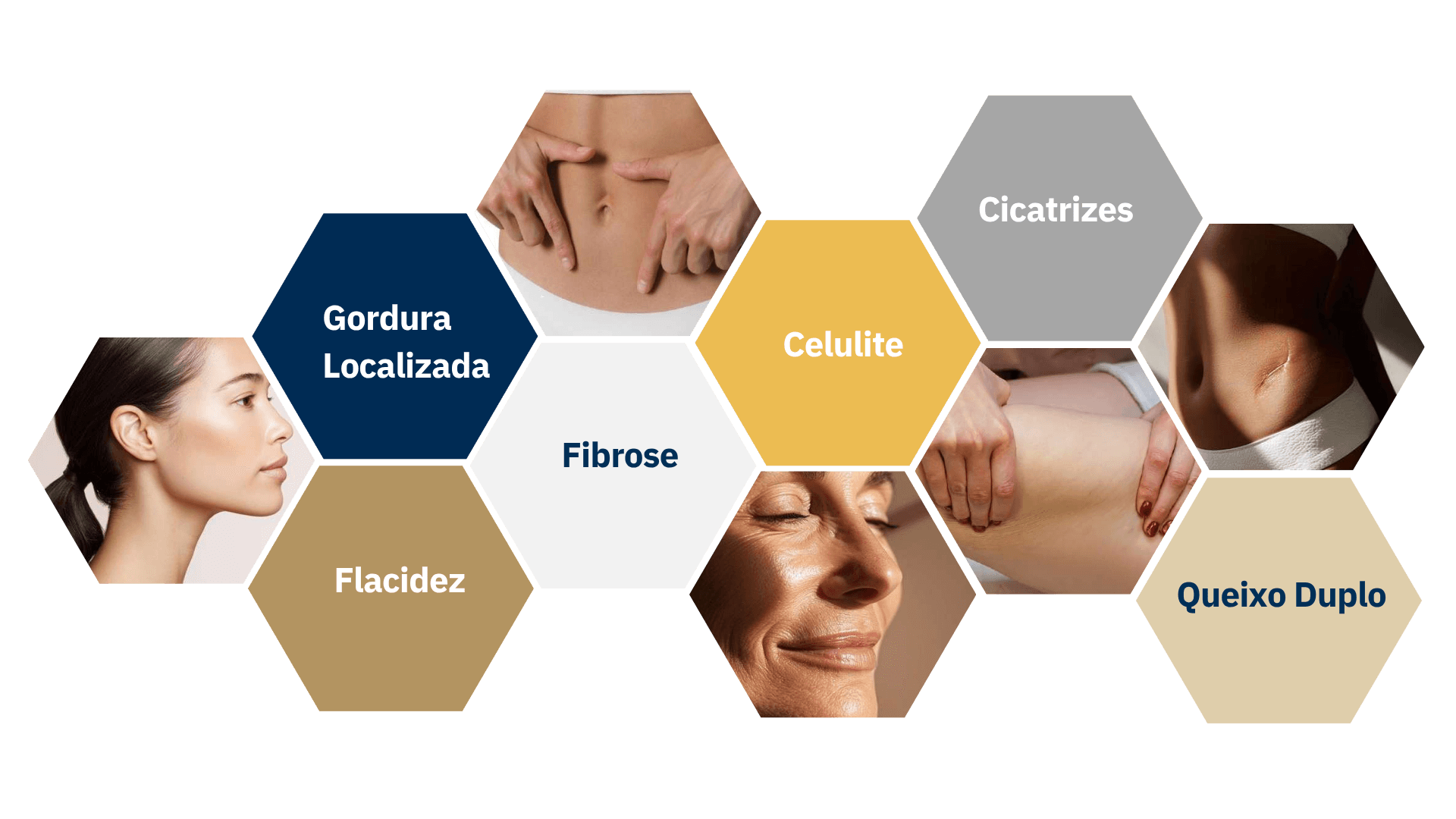 Mosaico de indicações clínicas: Gordura Localizada, Flacidez, Celulite, Fibrose, Cicatrizes, Queixo Duplo