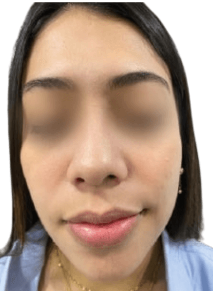 Depois - Cicatrizes